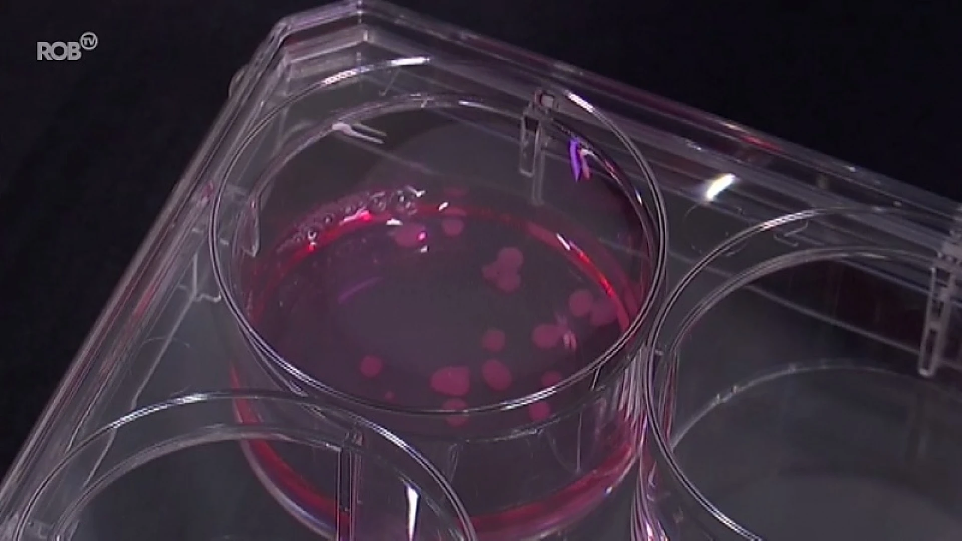 Primeur voor UZ Leuven: voor het eerst levend botweefsel in laboratorium gemaakt