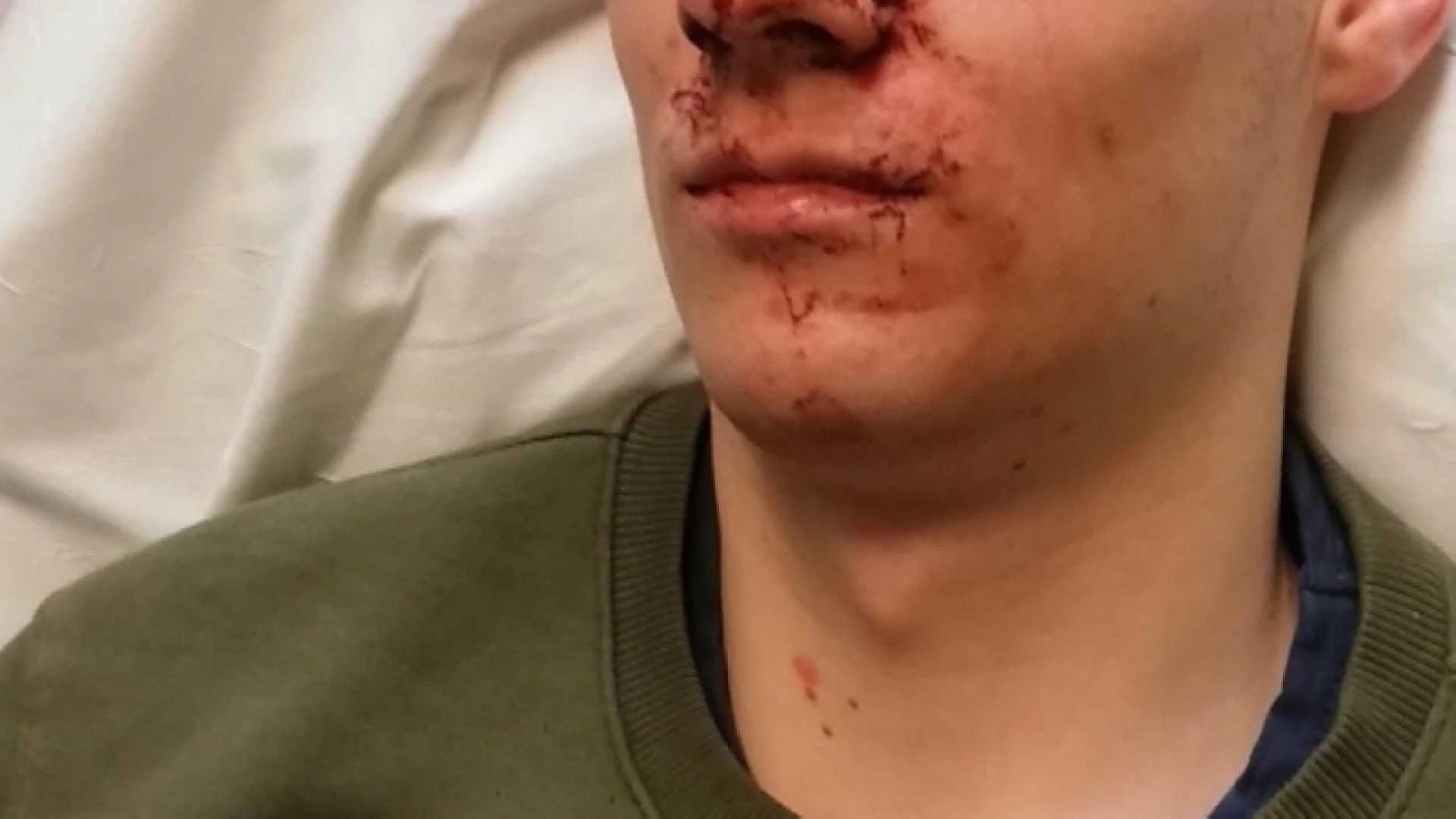 Politie moet negen keer tussenkomen tijdens Emmerkesfuif in Aarschot: jongen afgevoerd naar ziekenhuis