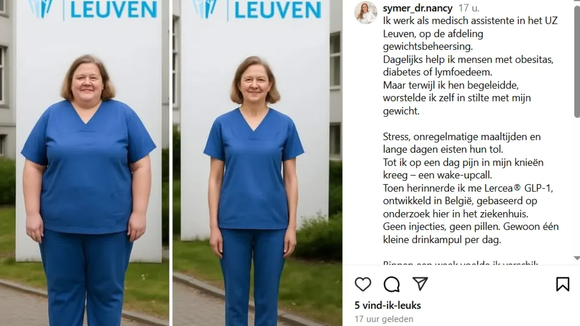 UZ Leuven waarschuwt voor valse advertenties op sociale media