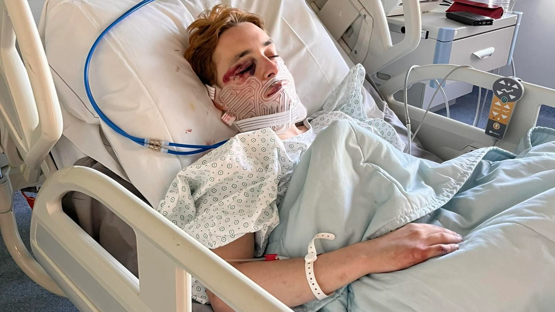 Tristan (23) krijgt harde klappen na feestje in Hoegaarden, politie Getevallei is een onderzoek gestart