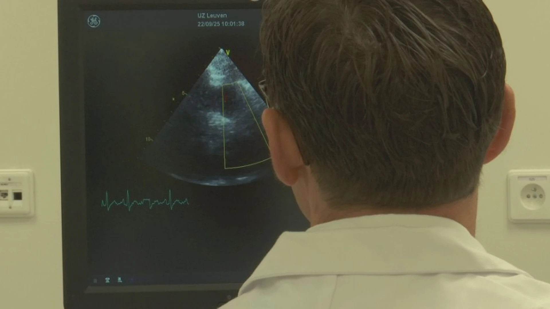 Cardiologen UZ Leuven zien verband tussen infecties en aangeboren hartaandoening: "Er lijkt een hoger risico te zijn"
