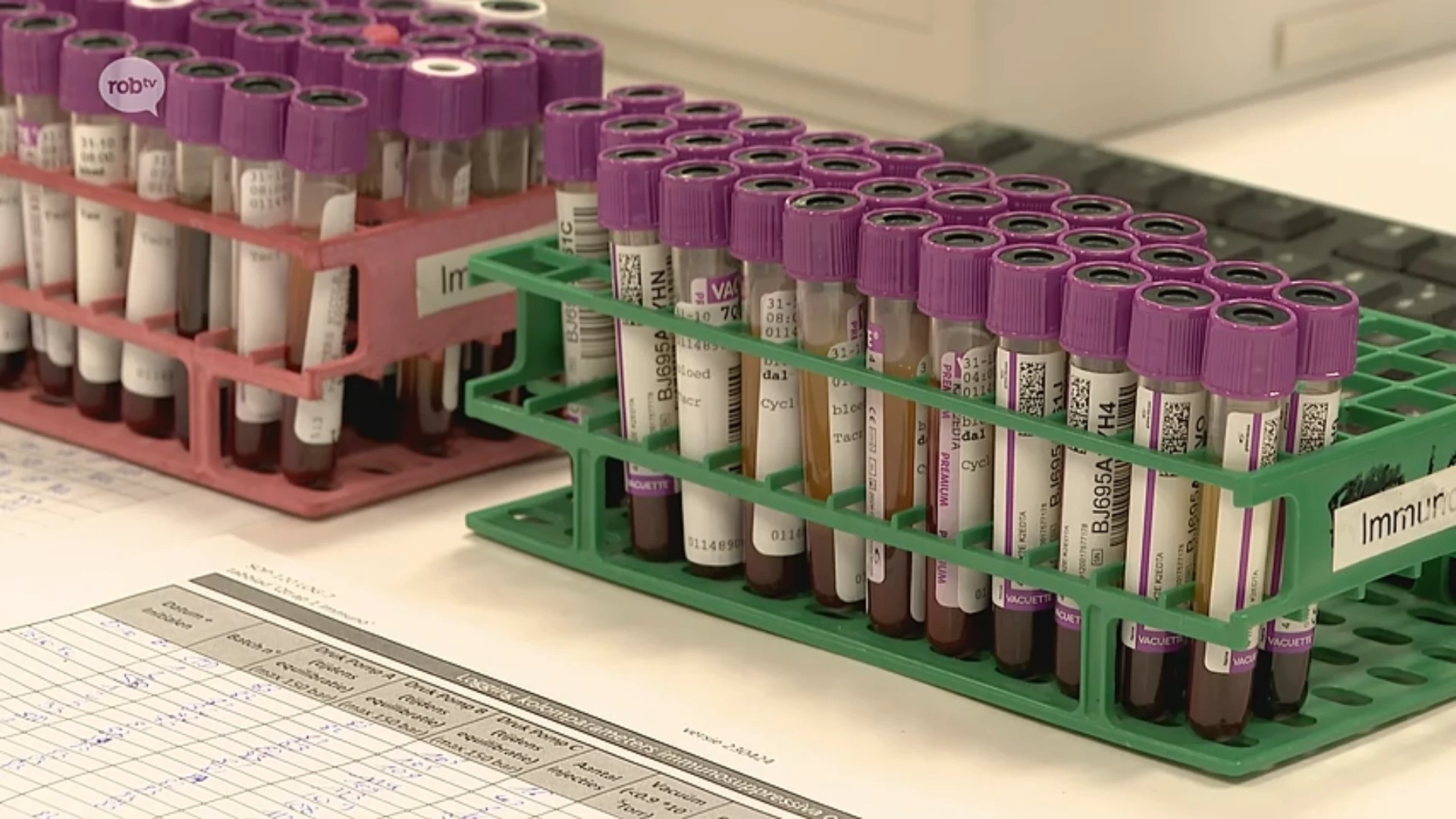 Hoofdafbeelding voor artikel Onderzoeksteam van UZ Leuven…