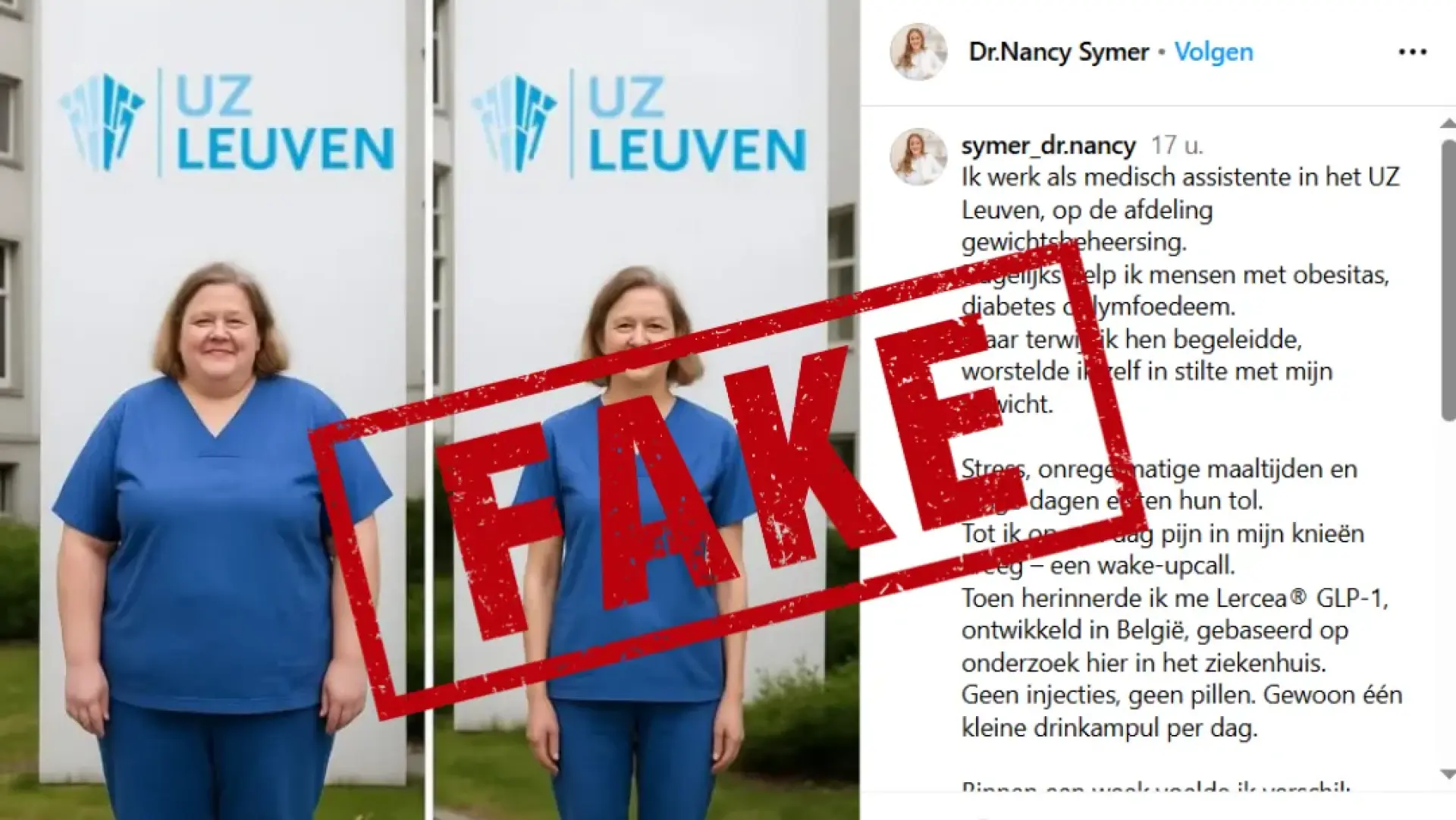 Hoofdafbeelding voor artikel UZ Leuven waarschuwt opnieuw…