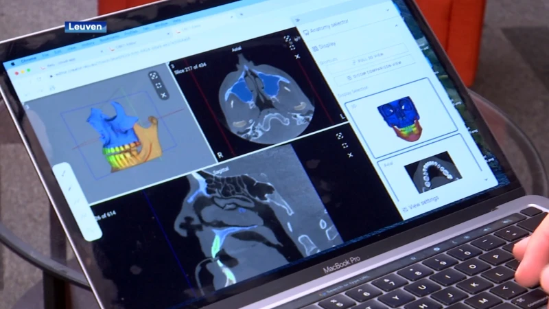 "Orthodontist kan resultaat beter inschatten", Leuvens bedrijf ontwikkelt 3D-model van het gebit