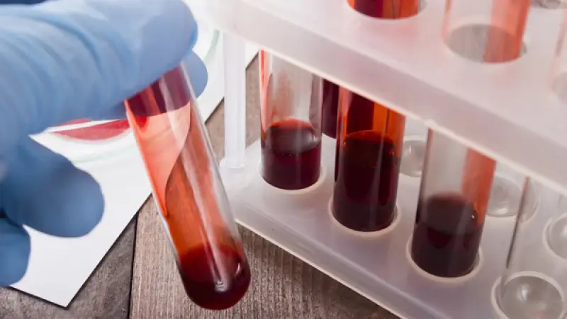 Onderzoekers KU Leuven kunnen aandoeningen vroeger opsporen dankzij DNA-onderzoek in bloed