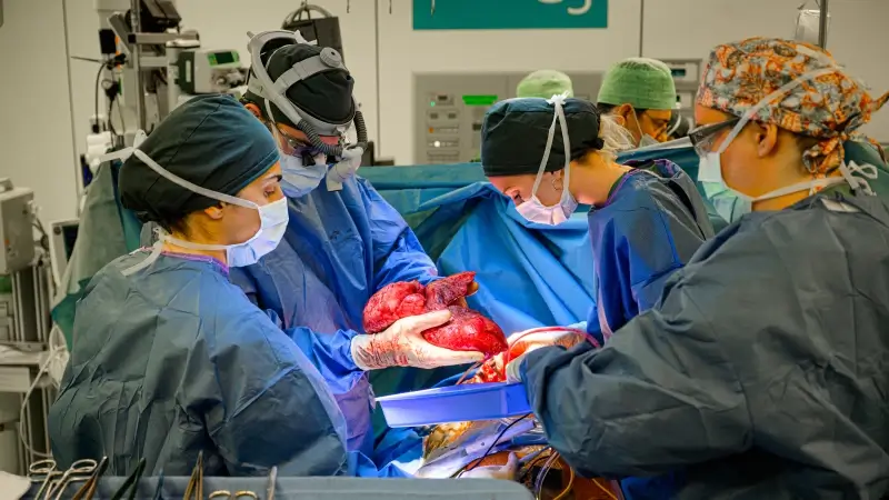 Belgische mijlpaal: UZ Leuven voert 1500ste longtransplantatie uit